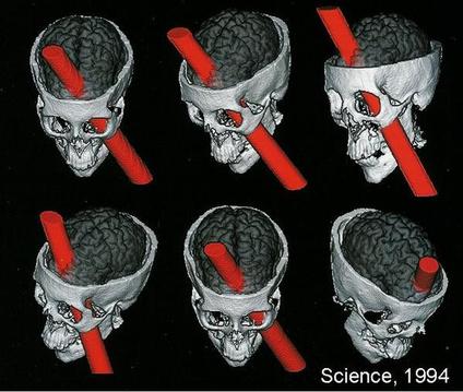 ෆීනියාස් ගේජ් Phineas Gage - ස්නායු විද්‍යා වංශ කතාවේ නොමැකෙන රෝගියා