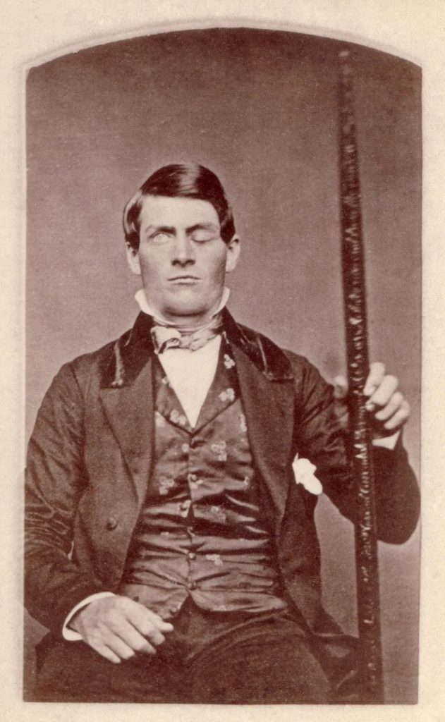 ෆීනියාස් ගේජ් Phineas Gage - ස්නායු විද්‍යා වංශ කතාවේ නොමැකෙන රෝගියා